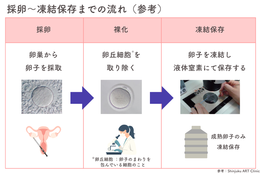 凍結保存までの流れ